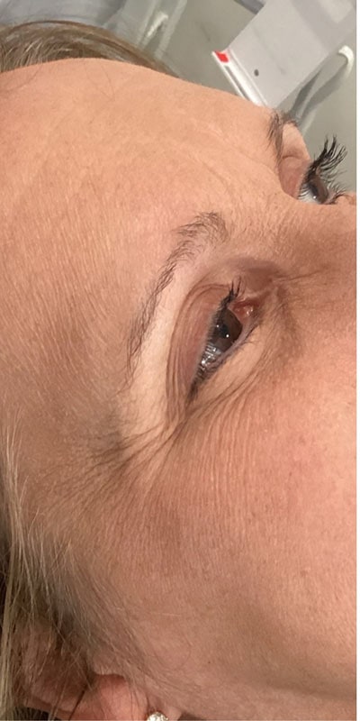 Brow Laminations Before & After Image