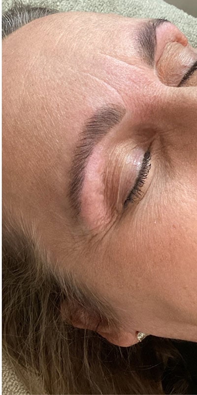 Brow Laminations Before & After Image