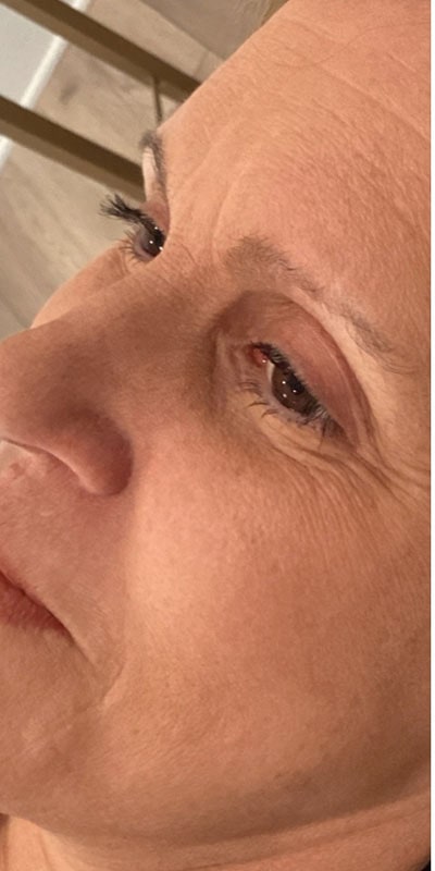 Brow Laminations Before & After Image